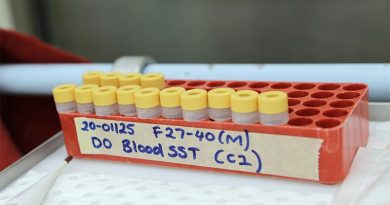 CSIRO is testing the COVID-19 vaccine candidates for efficacy. Photo supplied by CSIRO.