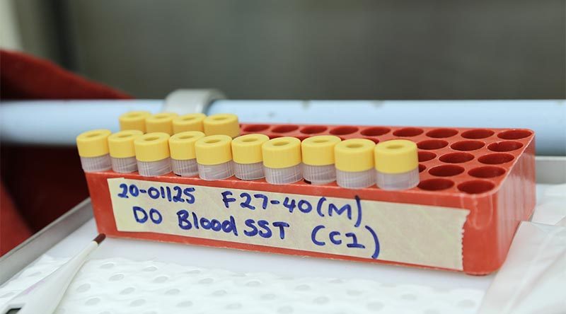 CSIRO is testing the COVID-19 vaccine candidates for efficacy. Photo supplied by CSIRO.